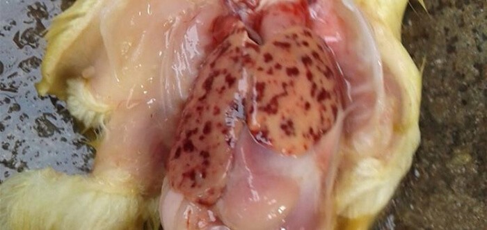 bệnh viêm gan virut