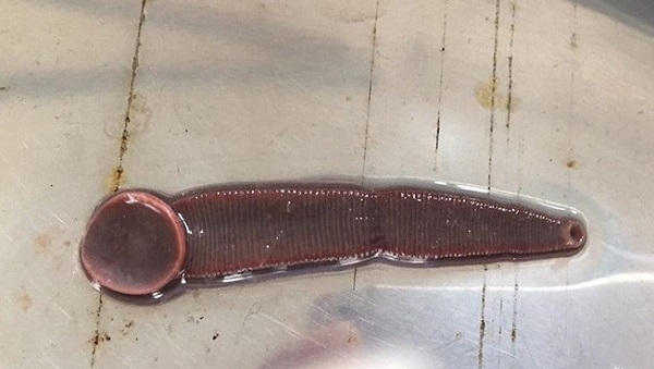 Bạn cần tham khảo ý kiến bác sĩ nếu chúng bám vào những khu vực nhạy cảm